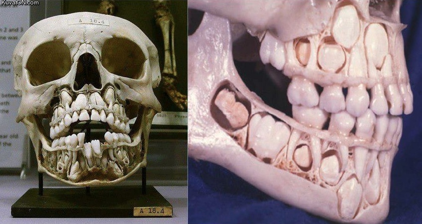a_childs_skull_before_they_lose_their_baby_teeth.jpg