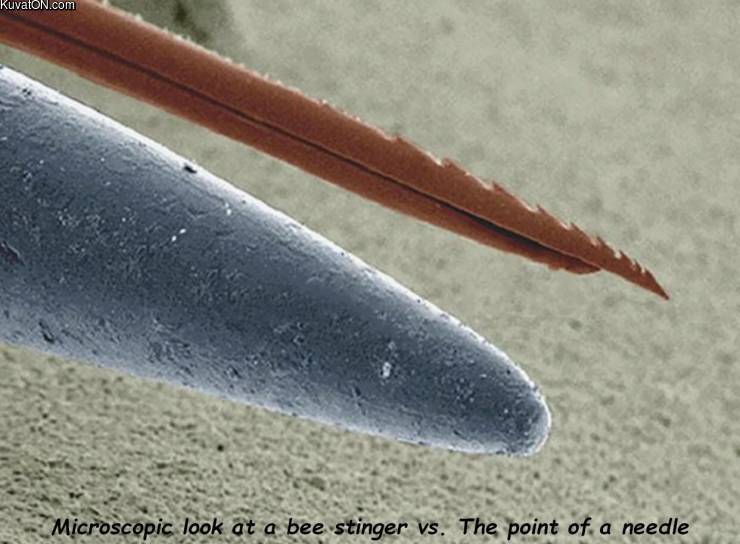 bee_stinger_and_needle.jpg