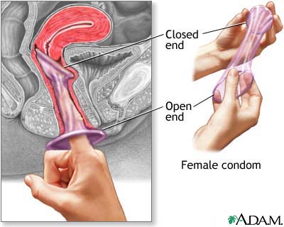 female_condom.jpg