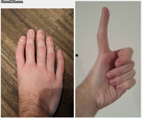 five_fingers_no_thumb.jpg