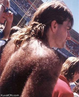 hairyback.jpg