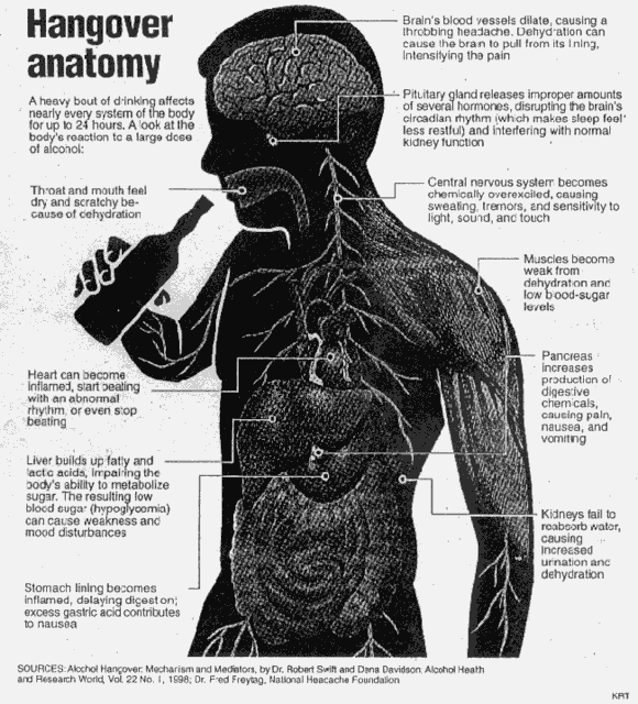 hangover_anatomy.gif