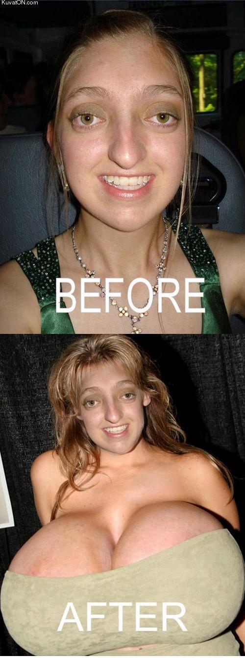 plastic_surgery_always_helps.jpg