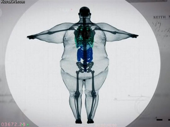 the_xray_of_a_900_pound_man.jpg