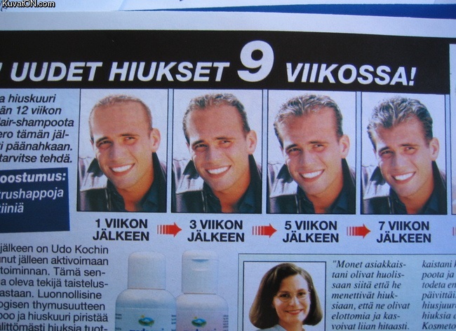 uudet_hiukset_9_viikossa_ilme.jpg