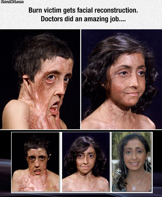 zubaida_hasans_amazing_face_reconstruction.jpg
