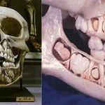 a_childs_skull_before_they_lose_their_baby_teeth.jpg