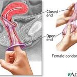 female_condom.jpg