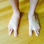 my_friend_has_rare_mutant_feet.jpg