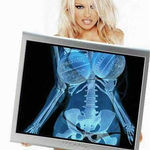 pam_anderson_s_x-ray.jpg