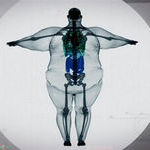 the_xray_of_a_900_pound_man.jpg